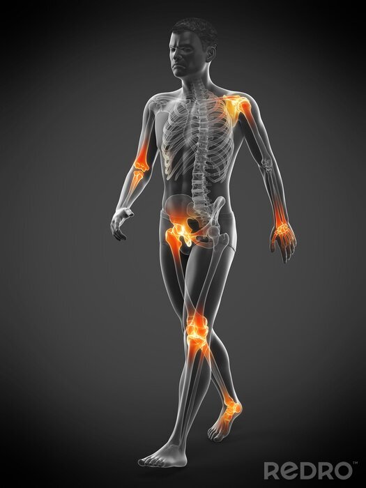 Canvas Mannelijke figuur met oranje gemarkeerde gewrichten