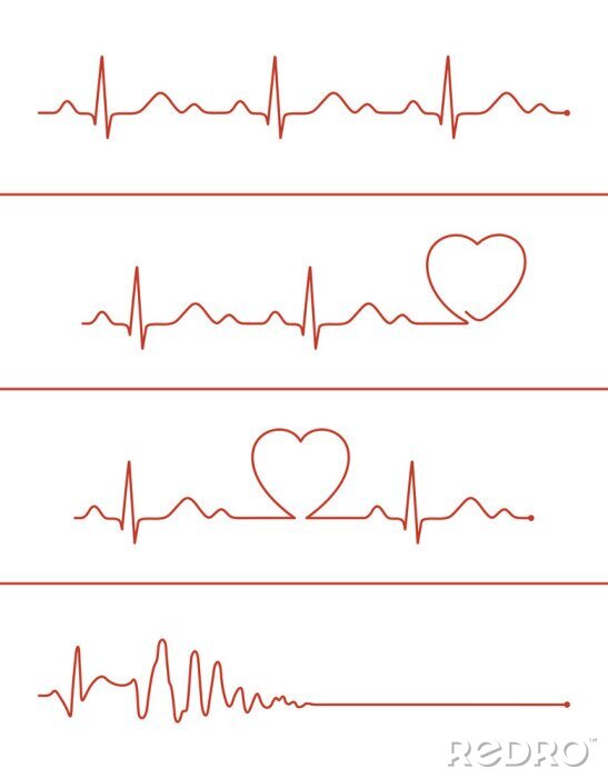 Canvas Set van verschillende cardiogram lijnen. Cardiogram lijnen van gezond hart en het hart stop