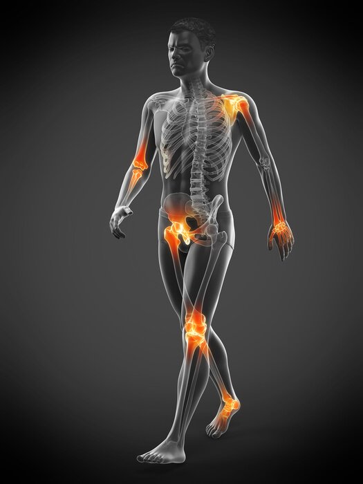 Poster Mannelijke figuur met oranje gemarkeerde gewrichten